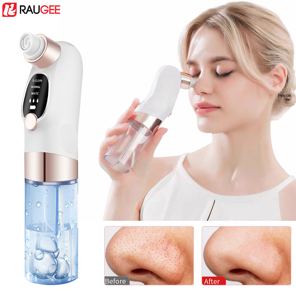Air Bubble Remover - Removedor de cravo elétrico extrator de