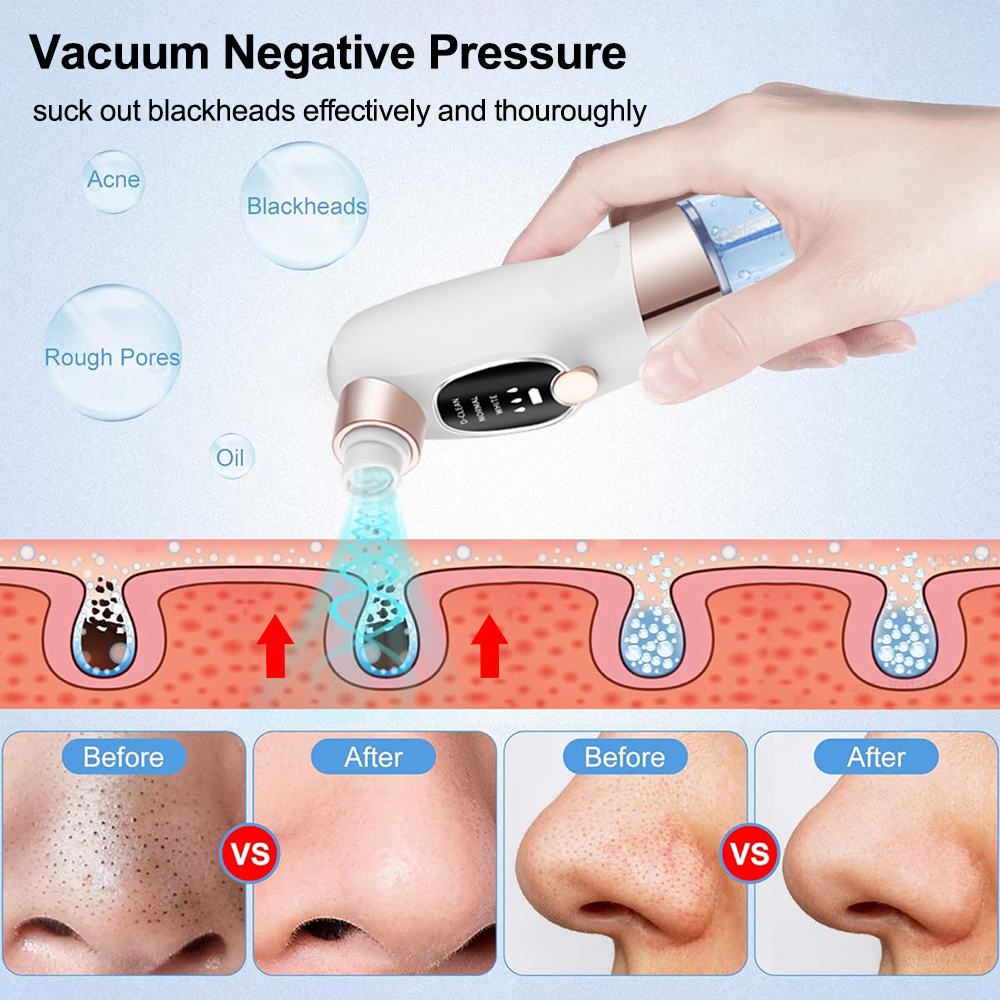 Removedor de cravo elétrico ex - Air Bubble Remover avaliação e preço